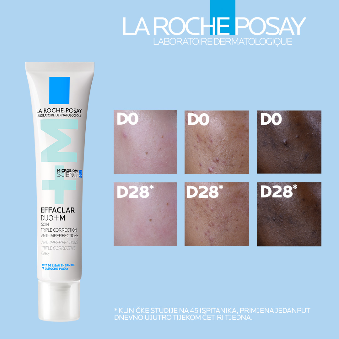 La Roche-Posay EFFACLAR DUO+M krema