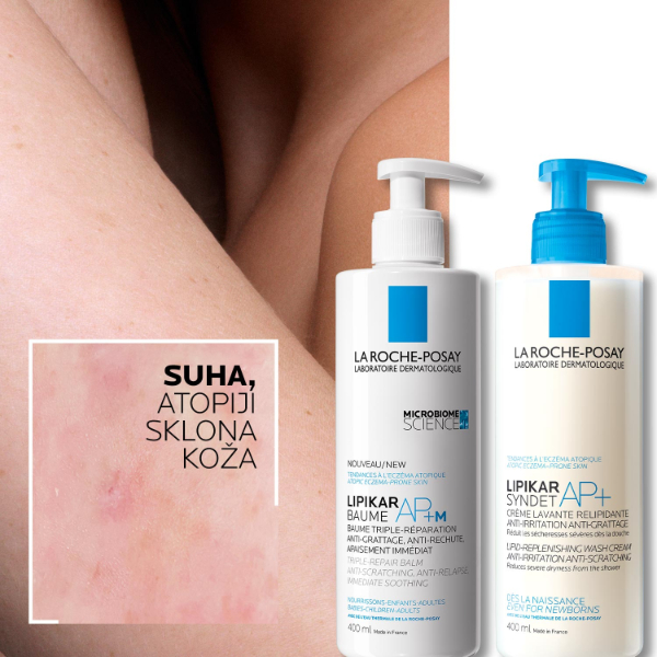 Atopijski dermatitis