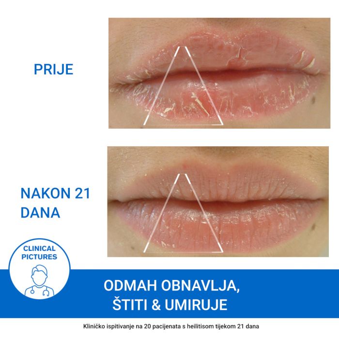 URIAGE Bariederm-cica balzam za usne - Slika 6