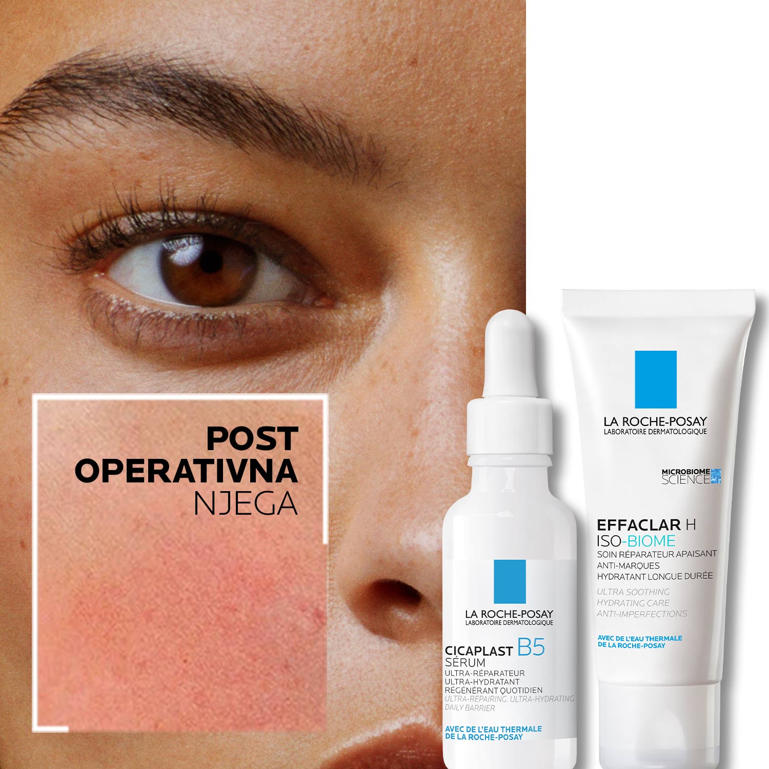 Post operativna njega